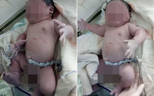 Kỷ lục: em bé sơ sinh nặng 7,1 kg
