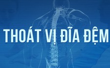 Toàn cảnh điều trị thoát vị đĩa đệm
