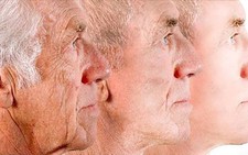 Trẻ lại 10 tuổi với công nghệ Laser Liposonic không phẫu thuật