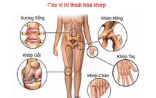 Thuốc điều trị, hỗ trợ trong bệnh lý về khớp