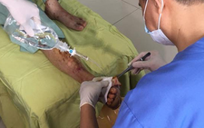 Kinh hoàng biến chứng bàn chân do mua thuốc trị tiểu đường