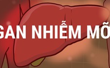 Giảm cân để chống chọi gan nhiễm mỡ