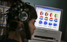 Nhật Bản phát triển hệ thống AI ‘đọc’ suy nghĩ của con người