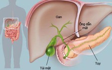 Ba bệnh viện phối hợp điều trị thai phụ bị bệnh hiếm gặp