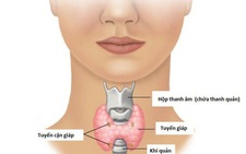 Israel đột phá trong phương pháp phát hiện ung thư tuyến giáp