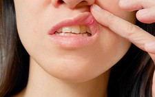 Khám, tư vấn miễn phí bệnh răng miệng