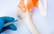 Nga thử nghiệm cấy ghép xương bằng kỹ thuật tế bào thế hệ mới