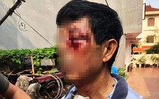 Xác minh nghi vấn đại úy công an đánh bác ruột bị thương