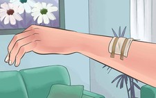 Chăm sóc trẻ tại nhà sau thủ thuật sinh thiết da