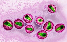Giới khoa học đã ở rất gần cách chữa bệnh HIV/AIDS