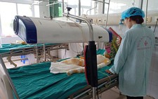 Tình hình sức khỏe 3 trẻ bị bỏng do cồn: Bác sĩ bảo 'chưa nói trước được'