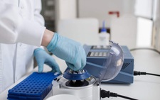 Sau vắc xin COVID-19, thế giới sẽ có vắc xin AIDS?
