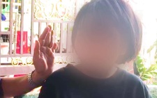 Nữ sinh bị thanh niên đánh dã man sau tai nạn: Phải nghỉ học, khâu 10 mũi trên đầu