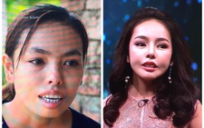 Cô gái bị miệt thị ngoại hình trở nên xinh đẹp hơn nhờ phẫu thuật thẩm mỹ