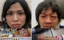 Mẹ và cha dượng đánh con gái 3 tuổi đến chết