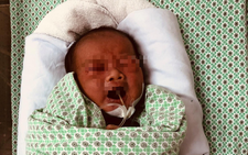 Bé sơ sinh bị bỏ rơi nhiễm khuẩn giác mạc, nhiễm trùng sơ sinh