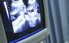 Hỏi đáp cùng thầy thuốc: Thường xuyên đau bụng quanh rốn, ợ hơi, ho liên tục, bệnh gì?