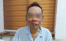 Ung thư khoang miệng đến biến dạng mặt vì không thể đi viện do dịch