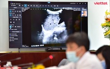1.800 ca COVID-19 nặng được hội chẩn qua Telehealth