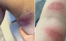 Kiến ba khoang 'tái xuất' ở TP.HCM