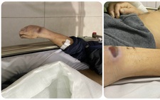Bắt cựu đội trưởng, đội phó công an huyện vì dùng nhục hình