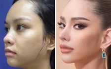 Netizen cười cợt hình ảnh chưa 'dao kéo' của tân Hoa hậu Hoàn vũ Thái Lan