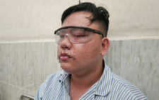 Thanh niên tố bị gậy cảnh sát giao thông ‘va’ vào mắt: Kiểm tra camera 'không thấy được gì'