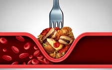Cholesterol cao, 4 dấu hiệu cảnh báo mỡ tích tụ