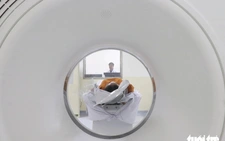 Trẻ dưới 5 tuổi bị va đập vùng đầu có nên chụp CT?
