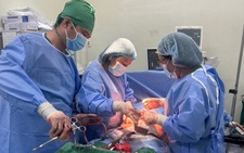 Mang khối u xơ to như thai 40 tuần mà không biết