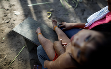 Scientists try to prove link between Amazon gold mining and disabilities in babies