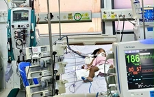 Delayed transfers, healthcare gaps, EV71 drive rise in child HFMD deaths in southern Vietnam