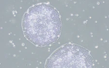 Japan oks world's 1st iPS cell treatments