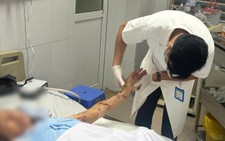 Hanoi doctors warn of heightened dog-bite risks for older adults