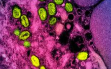 Monkeypox to be renamed mpox: WHO