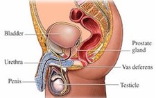 Bệnh ung thư tuyến tiền liệt