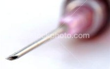 Khi nào cần xét nghiệm HIV/AIDS?