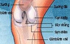 Thoái hóa khớp gối
