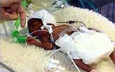 Trẻ sinh thiếu tháng bị ảnh hưởng đến nhân cách