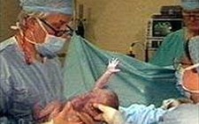 Hiện tượng sinh thiếu tháng gia tăng nhanh