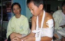 Teo cơ Delta, tại sao?