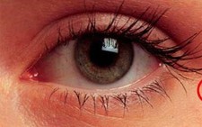 Mi mắt cũng có chấy rận