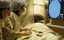 Coi chừng dị dạng mạch máu não!