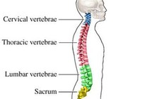 Phẫu thuật cong vẹo cột sống cho bệnh nhi