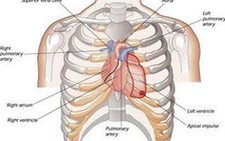Lắp đặt máy hỗ trợ tim