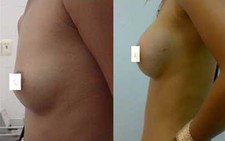 Thắc mắc chuyện 