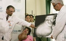 Bác sĩ Mỹ mổ khối u 7kg cho bé gái VN