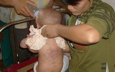 Đắc Nông: em bé 9 tháng tuổi bị 