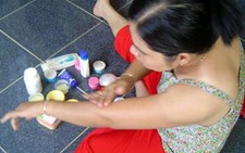 Da hư vì kem trôi nổi
