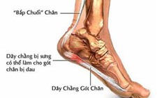 Ngồi lâu, đứng dậy đau thốn gót